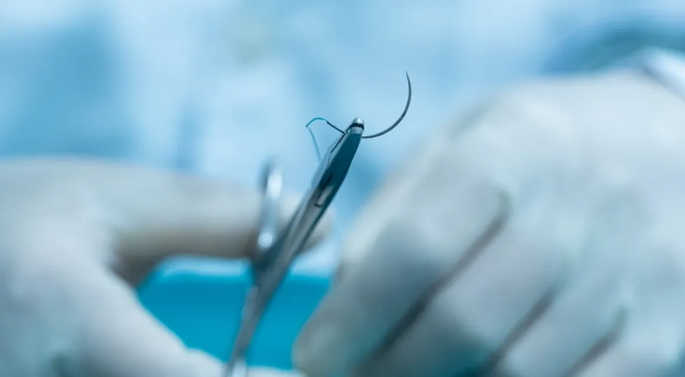 傷跡が目立ちにくい縫合技術