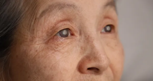 眼内手術の既往